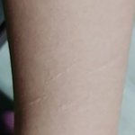 [댓글부탁해] 이거 <b>자해</b> 흉터같음?
