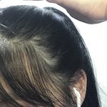 이거 <b>탈모</b>같은 년 여기 어떡해??