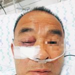 살인<b>미수</b>에 가까운