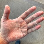 [꼭봐주세요] 안녕하세요. '코로나 <b>의료진</b> 손' 사진의 간호사 본인...