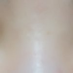 [댓글부탁해] 나 눈감아도 쌍수<b>자국</b>티 많이안나지않냥