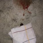 죽기 직전 구한 아기 고양이