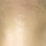 나 <b>짝눈</b> 많이 심해?ㅠㅠ