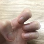 [댓글부탁해] 하 진짜 <b>손톱</b>뜯는거 끊어본사람ㅠㅠㅠㅠ
