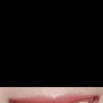 [이것좀봐줘] 내 <b>덧니</b> 꼴보기 싫어...? 교정해야할까?