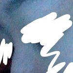 [드루와] <b>메부리</b> 진짜 스트레스인데 필러 맞을까