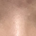 [흥이다] 나는 왜 쌍수 안알려주냐.. ㅜㅠ ㅠ(<b>재업</b>)