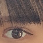 [댓글부탁해] 쌍수 붓기 마니 <b>심해</b>?