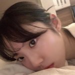 애덜아 쌍수 붓기 빠지면 눈 더 커져? 아님 작아져?