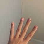 15년동안 <b>손톱</b>뜯었는데 고쳤다!!!