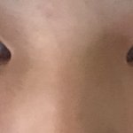 [이것좀봐줘] 콧볼때매 <b>코가</b>이상해