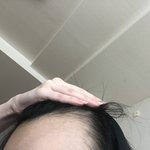 [드루와] 나보다 m자이마 심한 사람 나와버셈