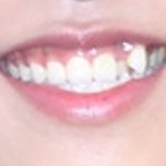 박우진 <b>덧니</b>랑