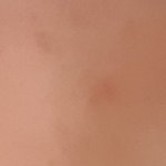 [댓글부탁해] 내 눈 쌍수 할<b>vs말</b> 좀 ㅠㅠ