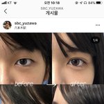 이거보니까 쌍수 하고싶다