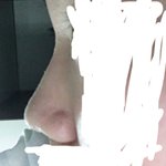 [댓글부탁해] 진지하게 코 <b>필러</b> 맞을까