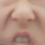 <b>팔자</b>주름 ㅅㅂ 이거 어켕 ㅜ