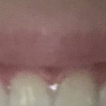 나 입꼬리 ㅈㄴ축<b>쳐</b><b>짐</b>. ㅠㅠ