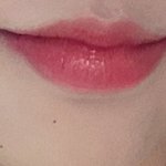 [19] 입술 <b>필러</b> 망한 후기 푼다.....