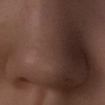 [ㅈㄱㄴ] 나 안면<b>비대칭</b> <b>교정</b>한거봐주라