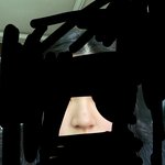 눈 비대칭이랑 콧볼 <b>축소술</b> 하려는데