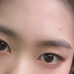 얘들아 이 <b>눈</b>에서 이 <b>눈</b>으로 재수술 ㄱㄴ?