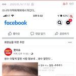 [댓글부탁해] 쌍수 ㅈㄴ잘됐다는 톡선 쓰니야