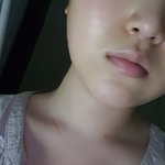 나 <b>피부</b> <b>개</b>좋아짐