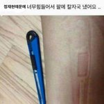 너무힘들어서 팔에 <b>칼자국</b> 냈어요 ..