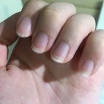내 <b>손톱</b> 이상함