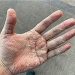 ㅅㅂ 돈이문제가아니고 건강은 생각안하냐고