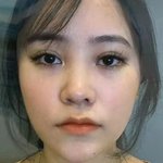 [댓글부탁해] 이 사람 코수술 <b>전후</b> 대박이지 않냐