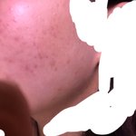 얘듀라 피부 더러워보이니..?혐주의)