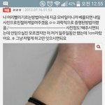 [댓글부탁해] 얘들아 이거 머리 빨리 자라는 방법이라는데 __<b>구라</b>인가