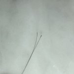 [댓글부탁해] 이거 머리 뽑힌거 <b>위에</b> 하얀거