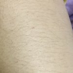 [댓글부탁해] 약혐) <b>팔털</b> 많이 극혐이야?