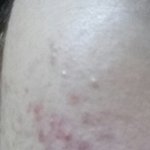 와 나 피부 좋아진거였구나;;