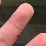 [드루와] 손가락에서 <b>피난</b>다 ㄹㅇ;;