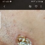 <b>의료</b>사고 정말로 문제가 많습니다