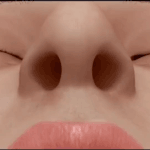 나 코성형 무조건 할랫는데