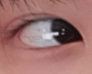 [댓글부탁해] <b>흰자</b>에 점 있는사람??