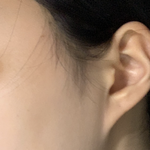 <b>귀밑</b>턱 ㅠ