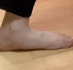 이거 <b>평발</b>이야 ??