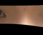 나 눈 사이 먼거 너무 스트레스임