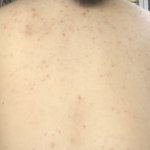 [댓글부탁해] (극혐)진짜 나보다 등<b>드름</b> 심한사람 있냐ㅠㅠㅠㅠ