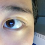 이렇게 하면 쌍꺼풀 생긴다고 했으니 <b>존버</b>한다