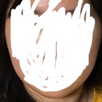 얘들아 나 옆광대<b>심해</b>?