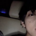 얼굴뾰루지에 방탄소년단 뷔의 <b>대처</b>법ㅋㅋㅋㅋㅋㅋ