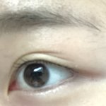 나 쌍수 <b>재수술</b> 해야될거 같지?