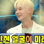 [댓글부탁해] 내 <b>눈</b>은 뭔 <b>수술</b> 해야됒